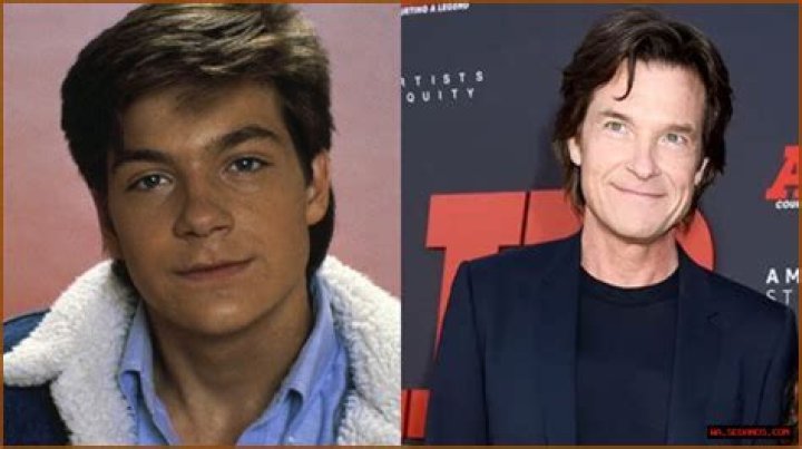 Jason Bateman Plastic Surgery Before and After